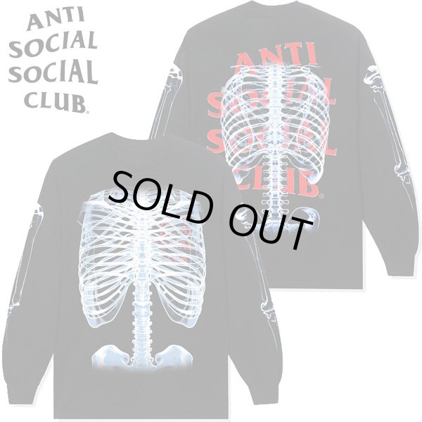 画像1: ANTI SOCIAL SOCIAL CLUB ( アンチソーシャルソーシャルクラブ ) - Bones Long Sleeve Tee (1)